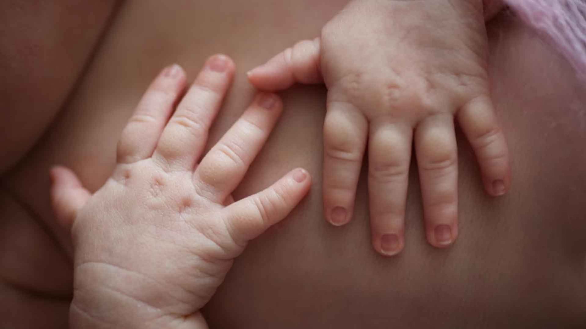 Yenidoğanın Cilt Bakım Sorunları